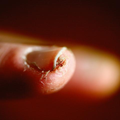 Nail Care 101: 9 Signs You Desperately Need a Manicure