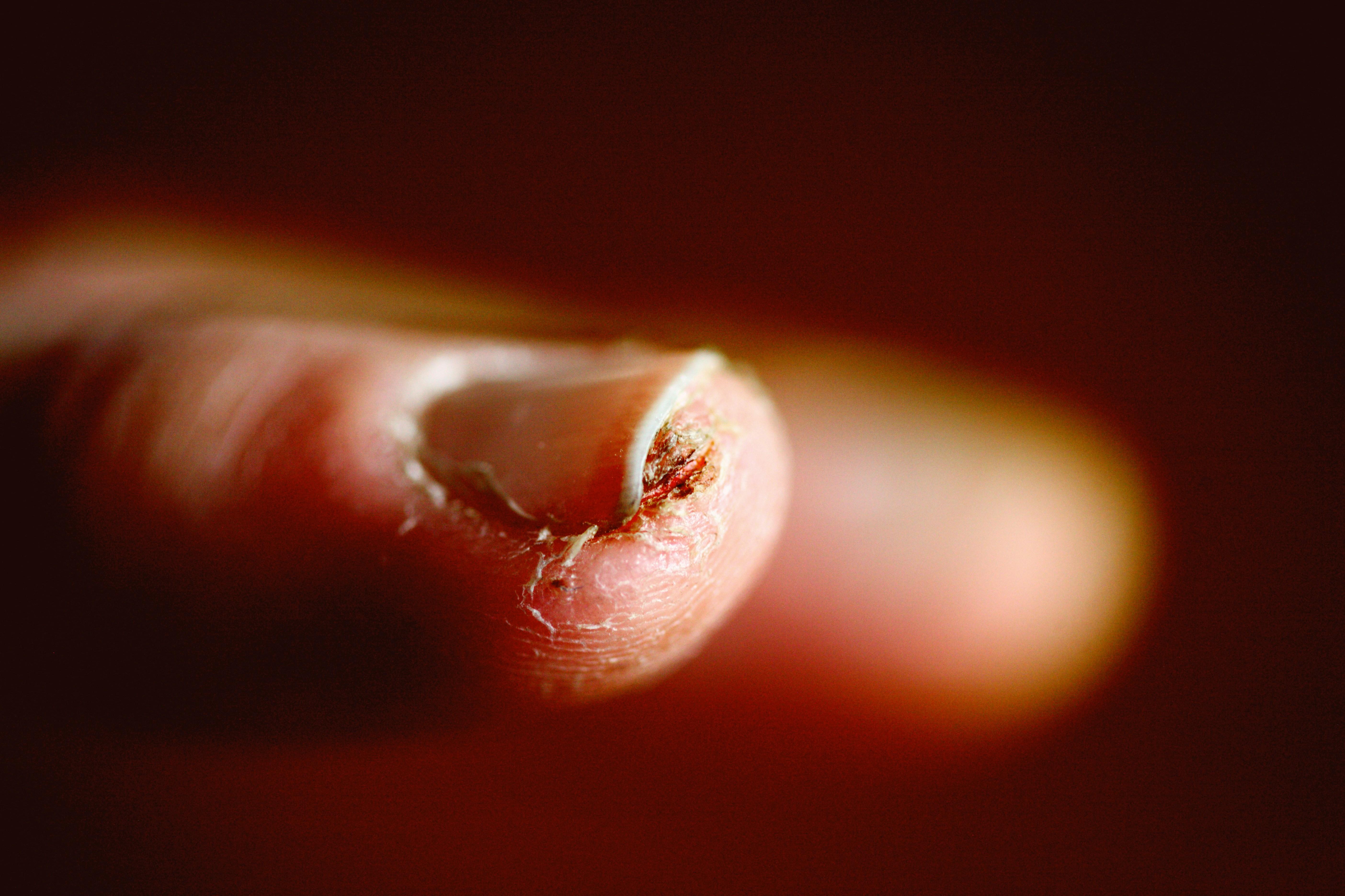 Nail Care 101: 9 Signs You Desperately Need a Manicure