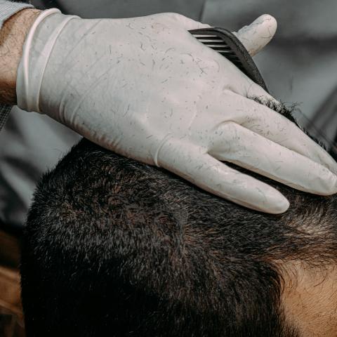 Revive Hair: Treatment Techniques for men